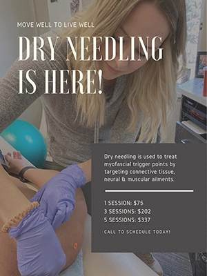 Chiropractic Oconto WI Dry Needling Therapy